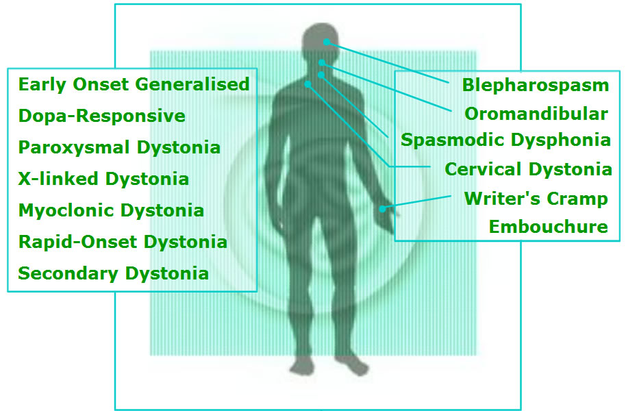 Forms of Dystonia